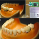Image for article titled Who Wants a Tooth That Tells Your Doctor When You Drink or Smoke?